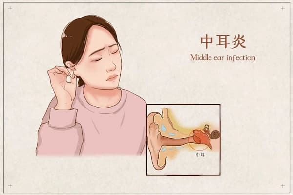 中耳炎洗完澡要不要用棉签掏,中耳炎洗耳朵怎么这么痛