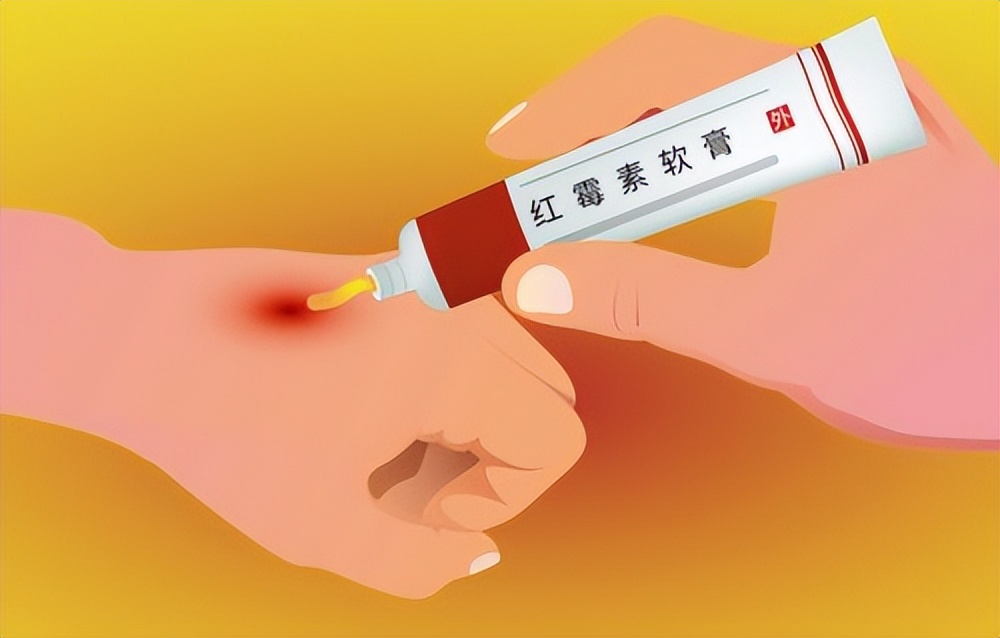 为啥老人斑会自行掉了,有人说红霉素软膏治老年斑