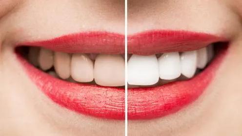 牙齿暗黄怎么样才可以刷得干净,牙齿发黄怎么办教你技巧轻松去除