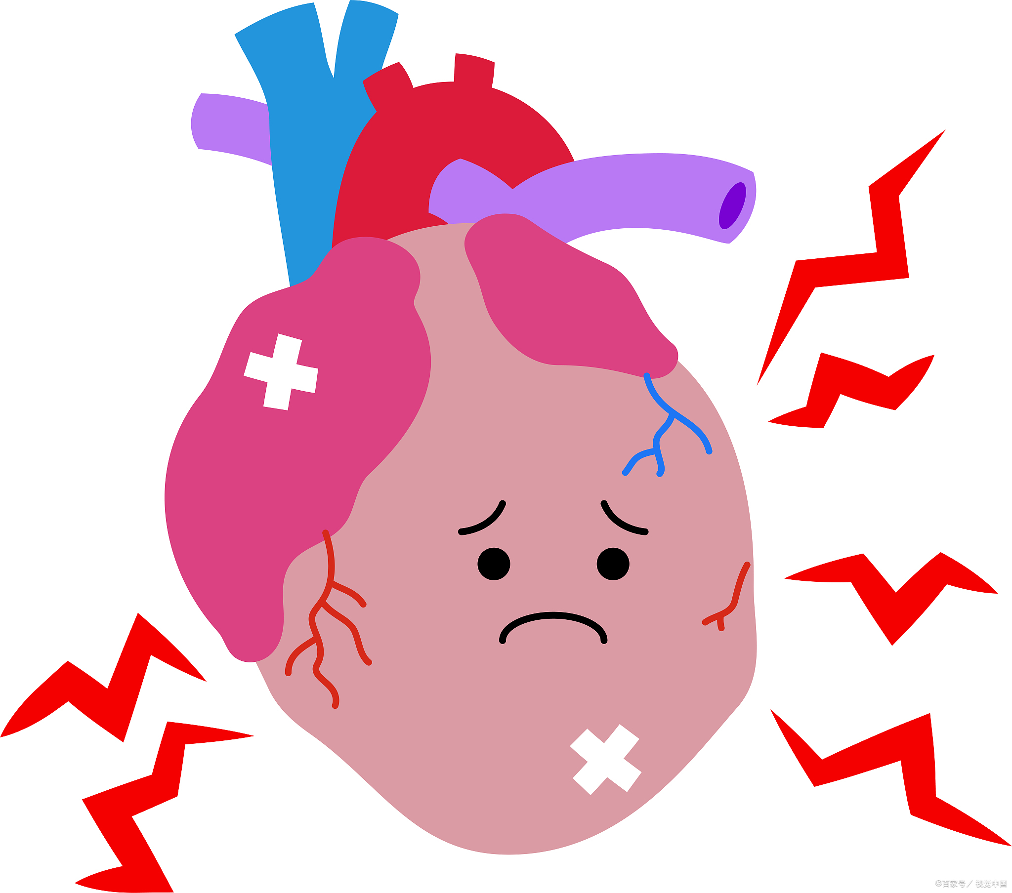 冠心病患者胸闷心慌心悸怎么办,冠心病心慌心悸气短吃什么中成药