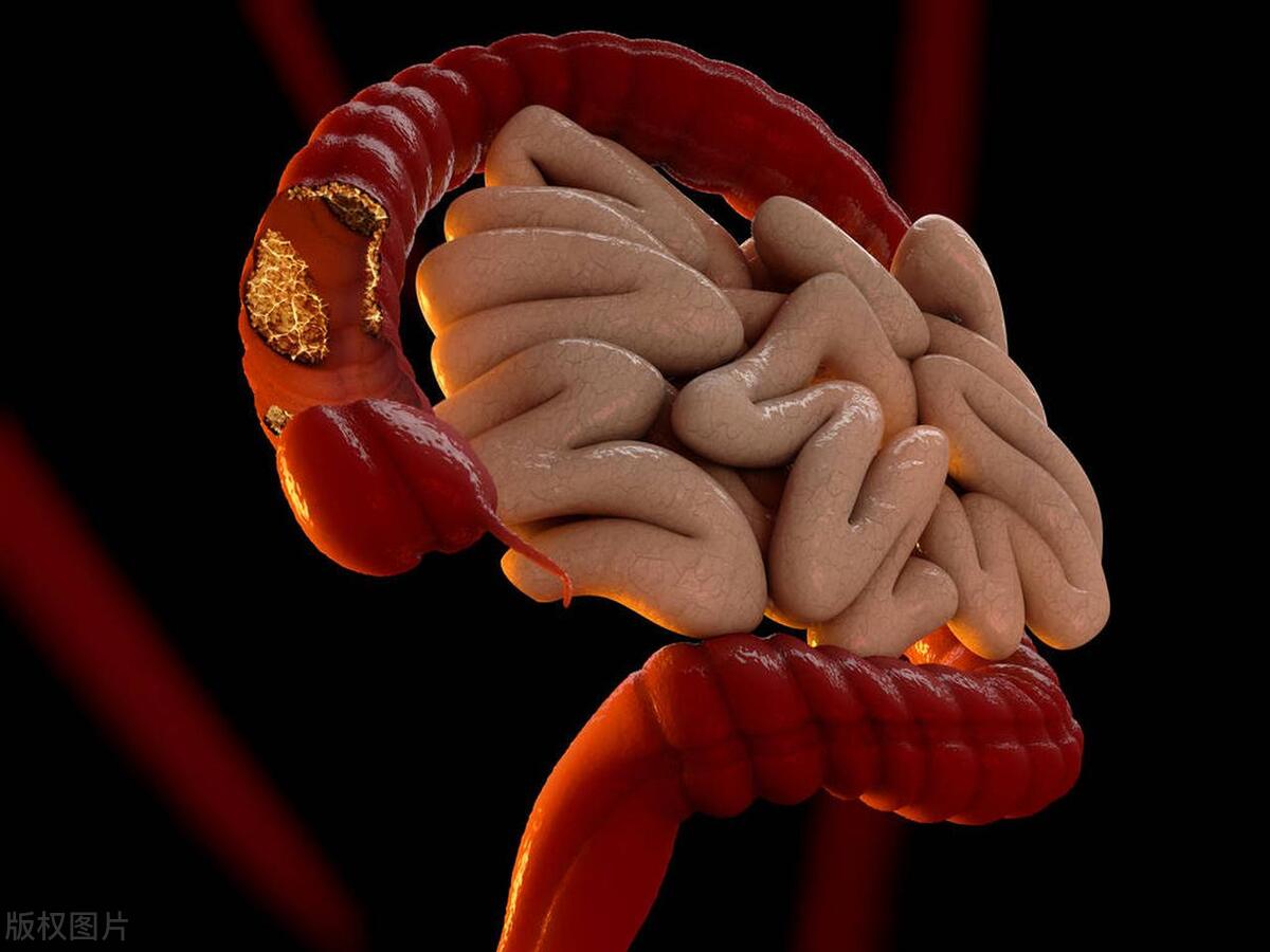 梅毒的症状潜伏期最长多长时间,梅毒的潜伏期一般为多长时间