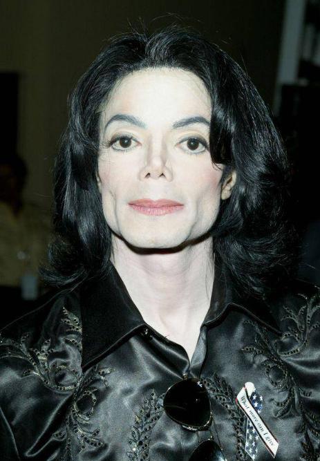 全世界整容最失败的女人,盘点那些整容的女人