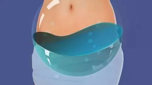 关于盆腔积液，你需要知道这些