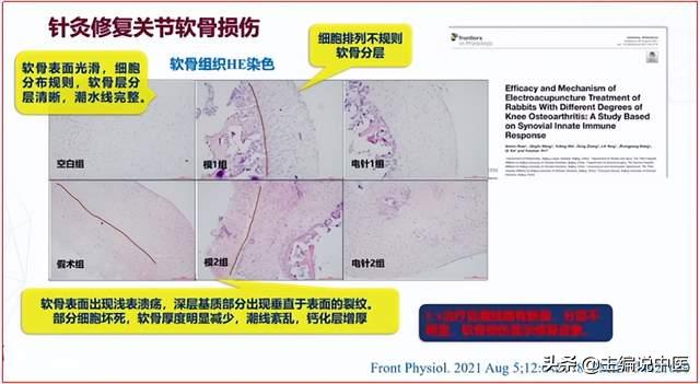 针灸治疗关节炎效果怎么样,针灸能治腿关节炎吗