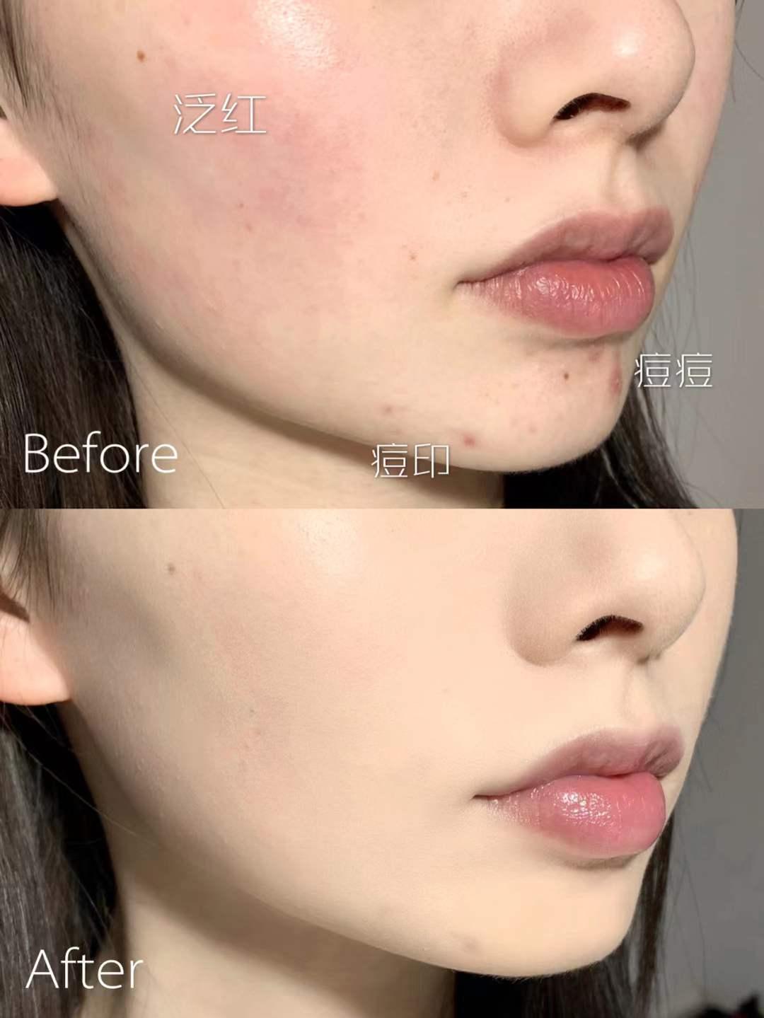 ysl皮革气垫和兰蔻菁纯气垫,公认好用的四大气垫