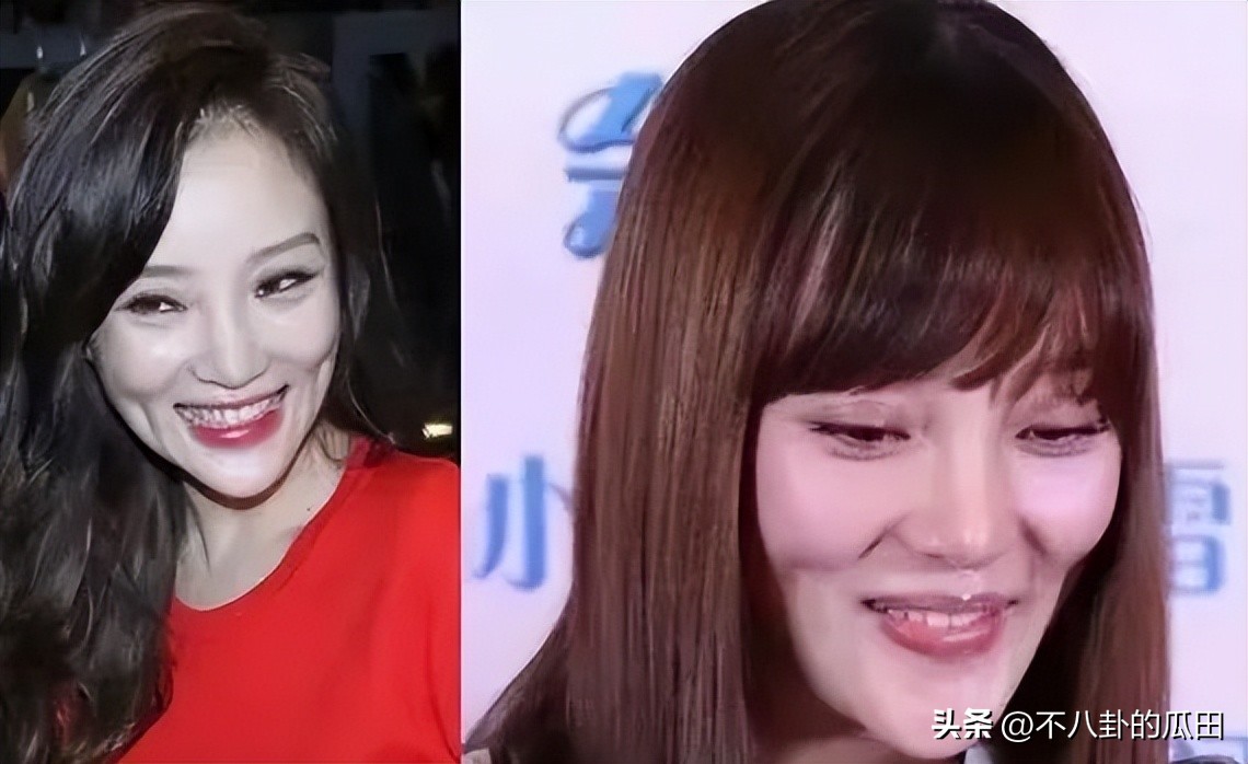 蔡徐坤下巴太尖惹争议图片,蔡徐坤下巴是假体吗