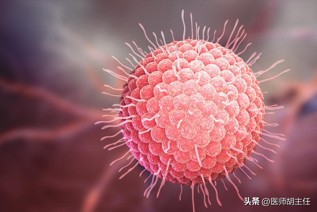 带状疱疹令人疼痛难忍该如何预防,哪些是带状疱疹患者要纠正的误区