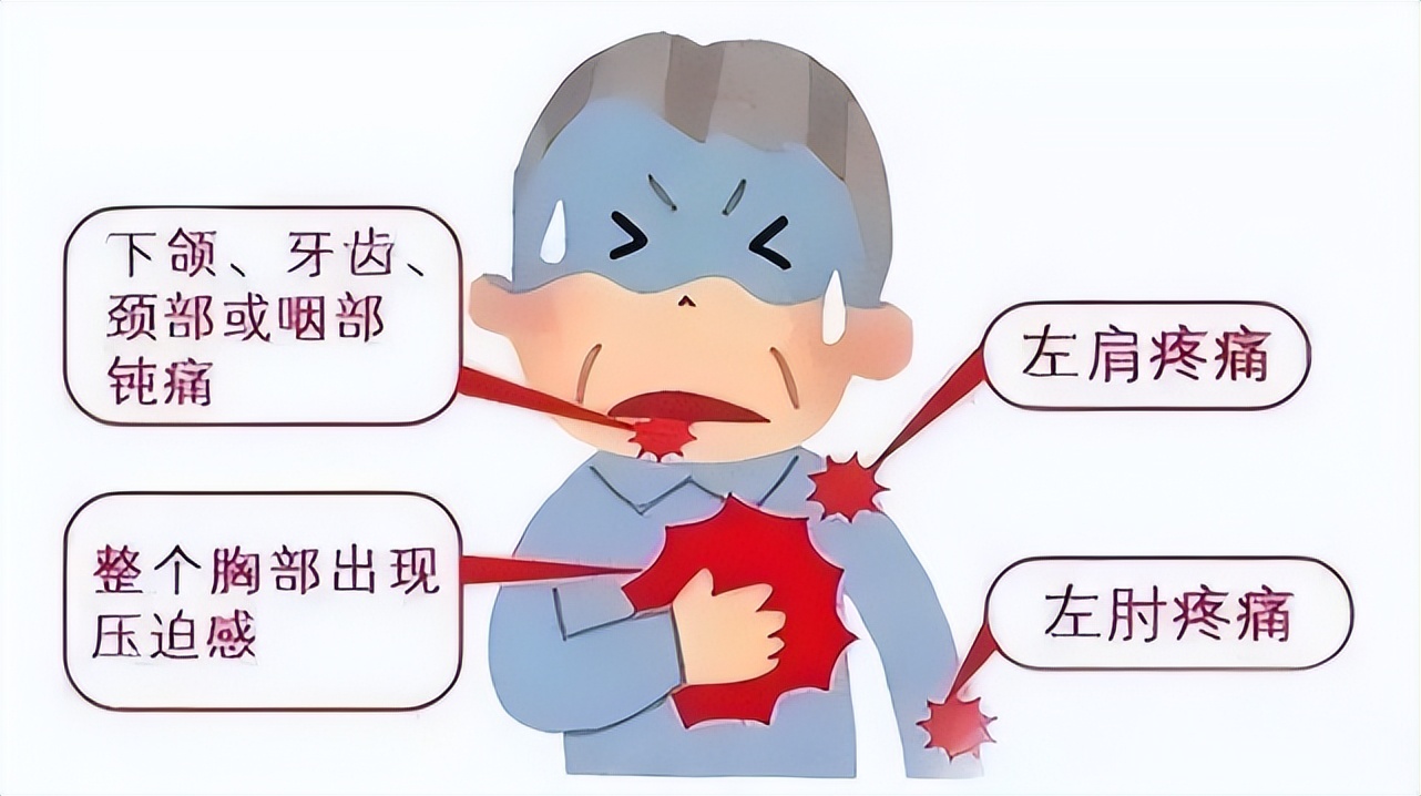 冠心病引起的心绞痛是怎么样的,冠心病出现心绞痛就是严重了吗