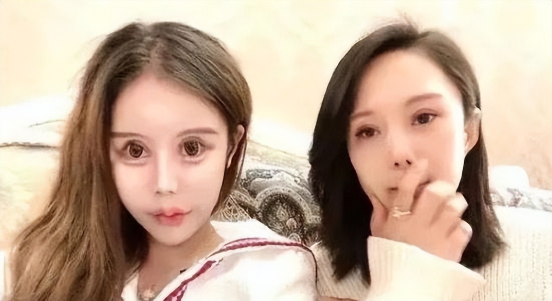 15岁网红自曝整形超100次，后遗症记忆力衰退，换脸停不下来