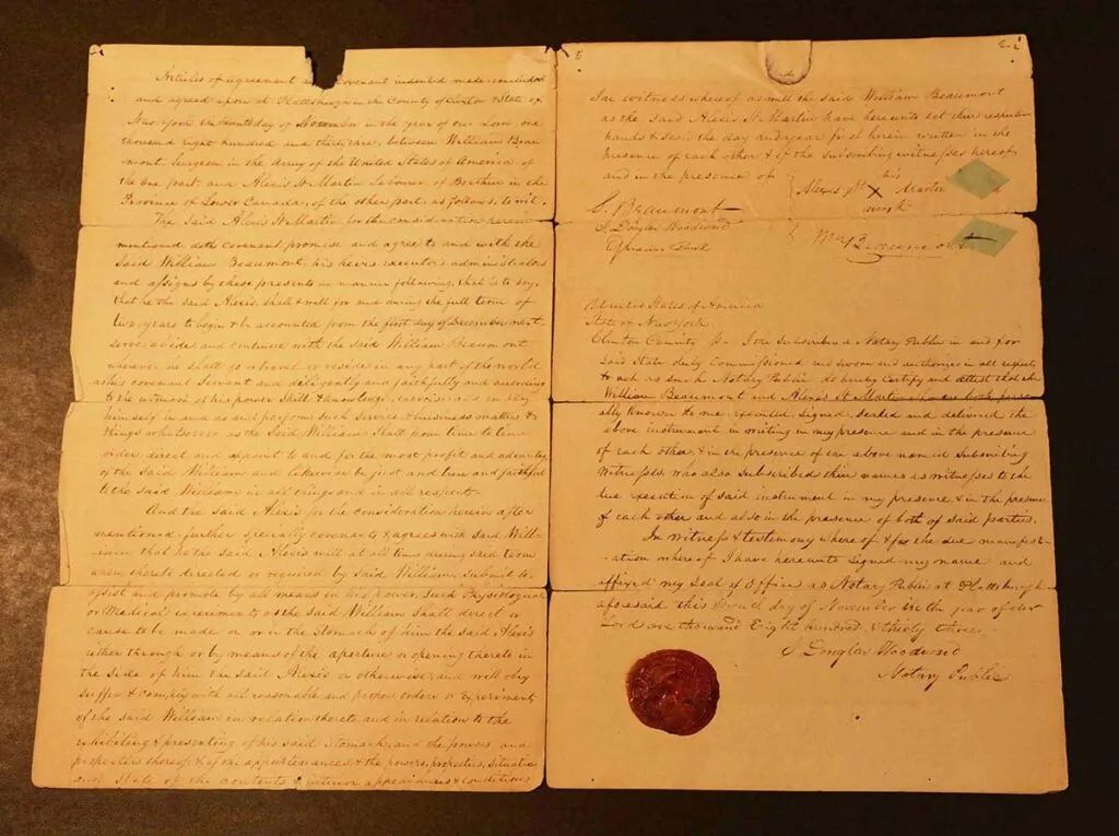 胃部开洞58年，一个普通人的痛苦如何成就消化系统生理学？