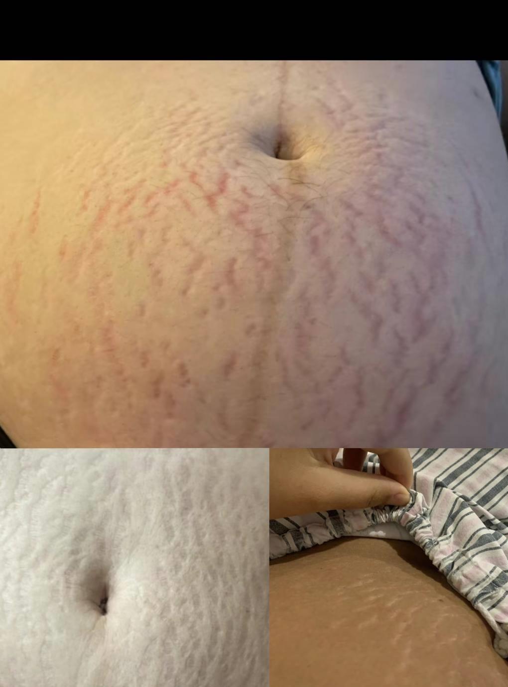 江苏产妇，拍下产床抓痕视频，引发女性关注和讨论