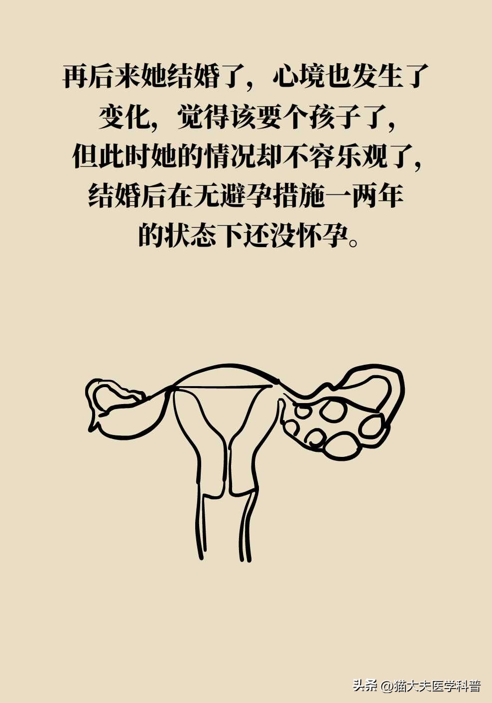 如果不要孩子多囊卵巢需要治疗吗,多囊卵巢综合征有必要治吗