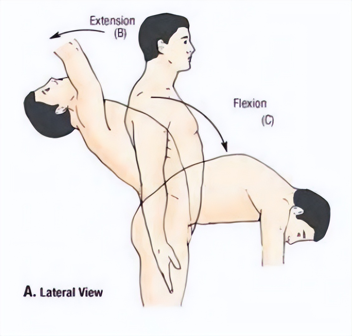 治疗强直性脊柱炎必须按体质治吗,针对强直性脊柱炎最好的锻炼方法