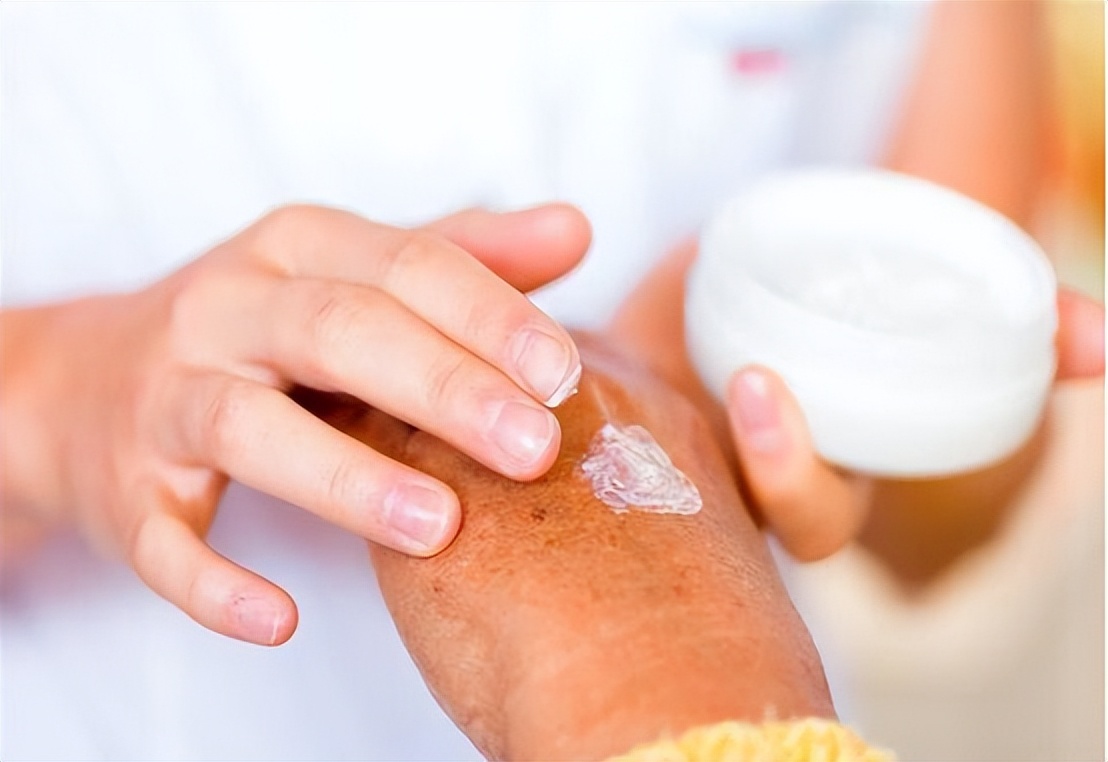 医生：2块钱一支的红霉素软膏不是万能药，别乱用