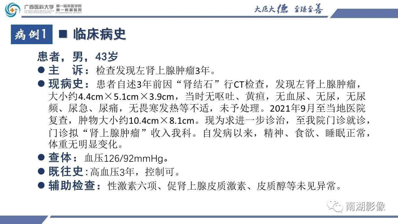 肾上腺海绵状血管瘤,肾上腺血管瘤是良性还是恶性