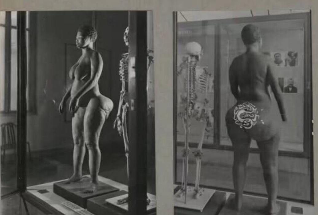 非洲女孩巴特曼因有巨臀，一生被赤身裸体展览，死后还被做成标本