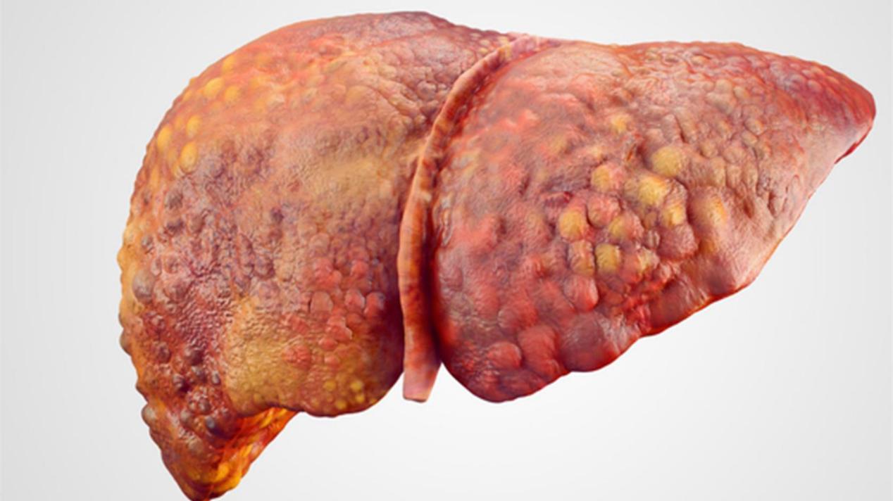 酒精是一级致癌物为什么有人还喝,酒精是一类致癌物还是尽量别喝