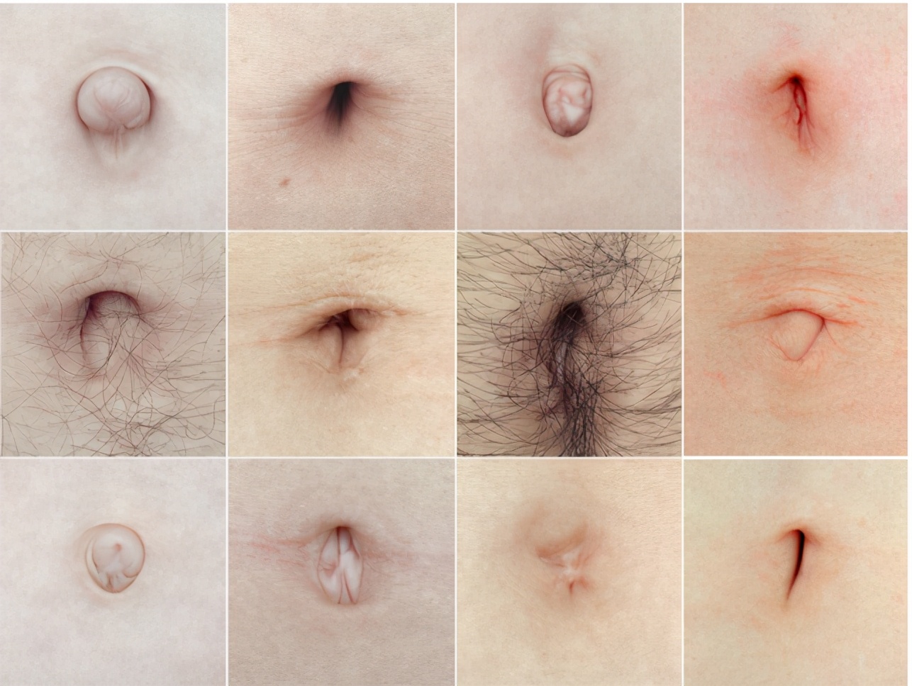 为什么抠肚脐眼肚子痛怎么缓解,抠肚脐眼肠子疼