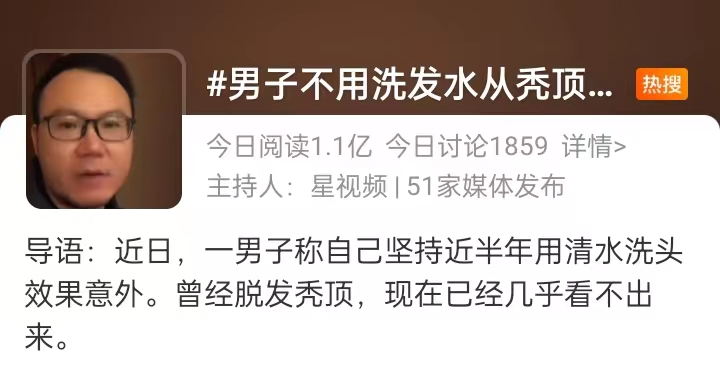 生姜洗发水真有防脱生发功能吗,哪个牌子生姜洗发水生发效果最好