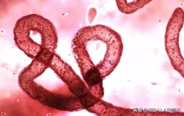 刚果金再现埃博拉病毒,刚果金爆发病毒死亡人数