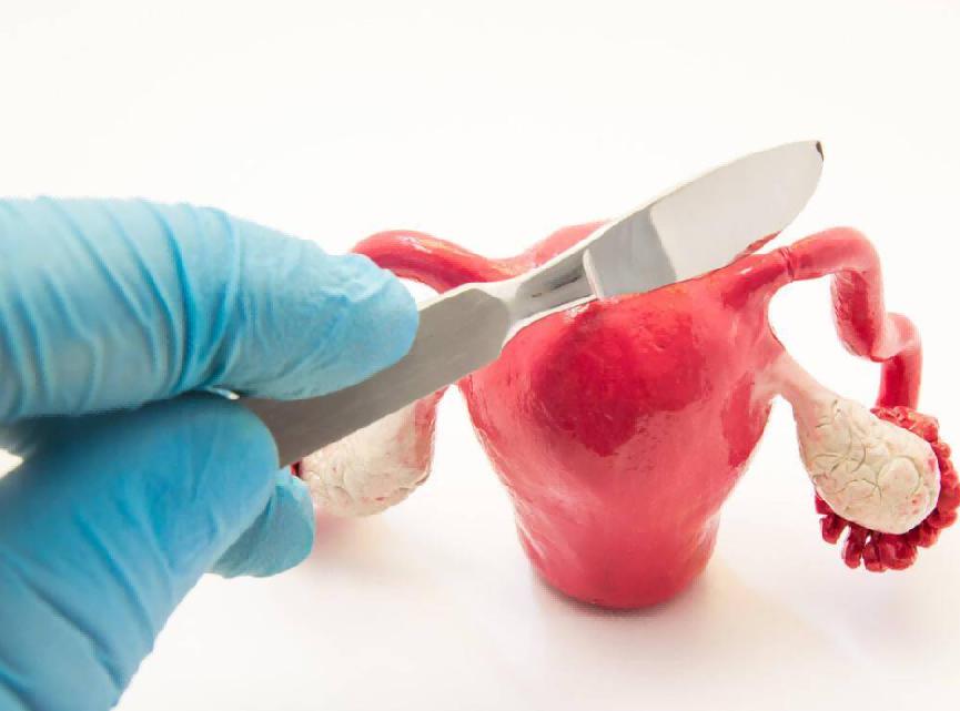 为什么不建议女人去做某些手术，医生用一个个血淋淋的例子告诉你