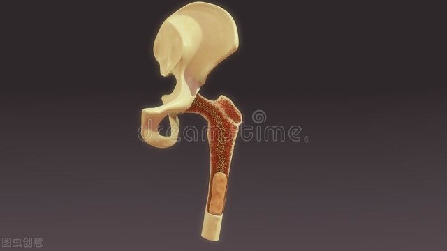 mds骨髓增生异常综合征特效药,mds骨髓增生异常综合征如何食补