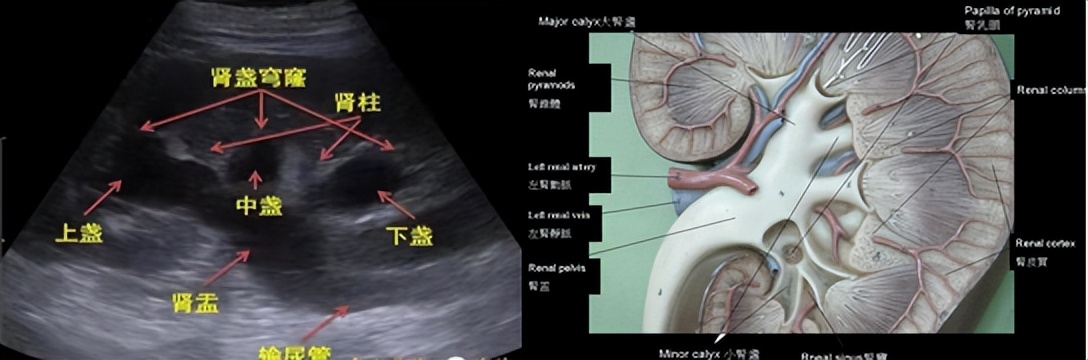 明知山有虎,偏向虎山行——肾斗士VS肾结石