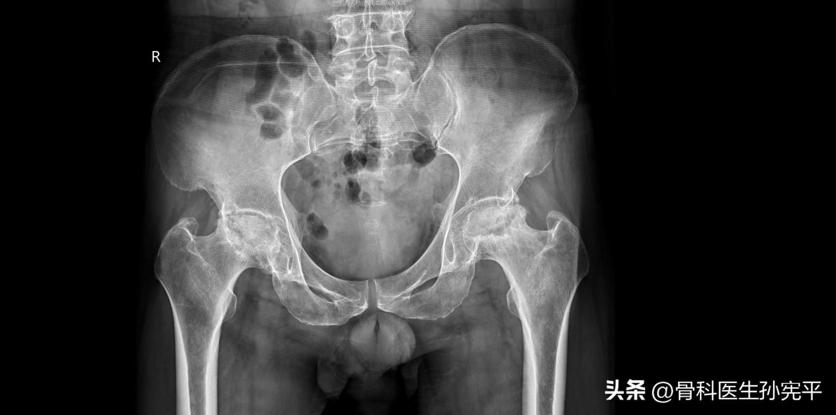 医学影像趣图,震撼的医学影像