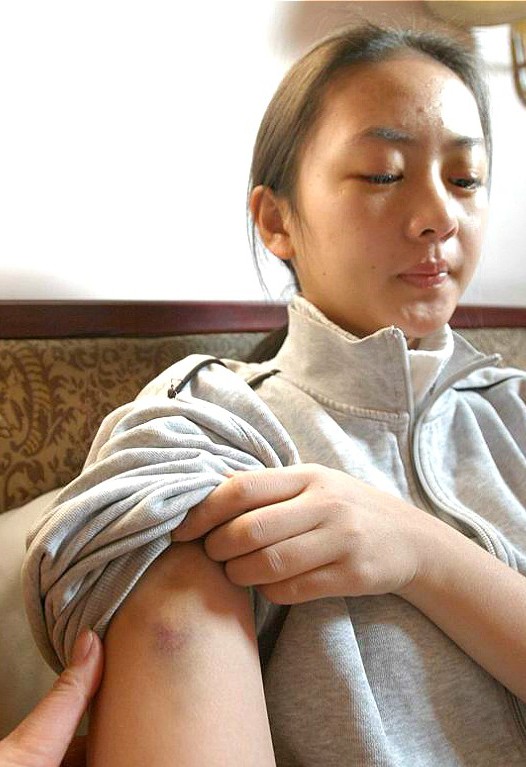 童瑶被张默打后如何翻身,童瑶哪一年被张默打的