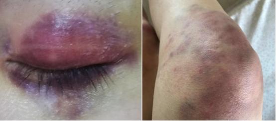 黑暗荣耀女主,黑暗荣耀女主被欺负的很惨吗