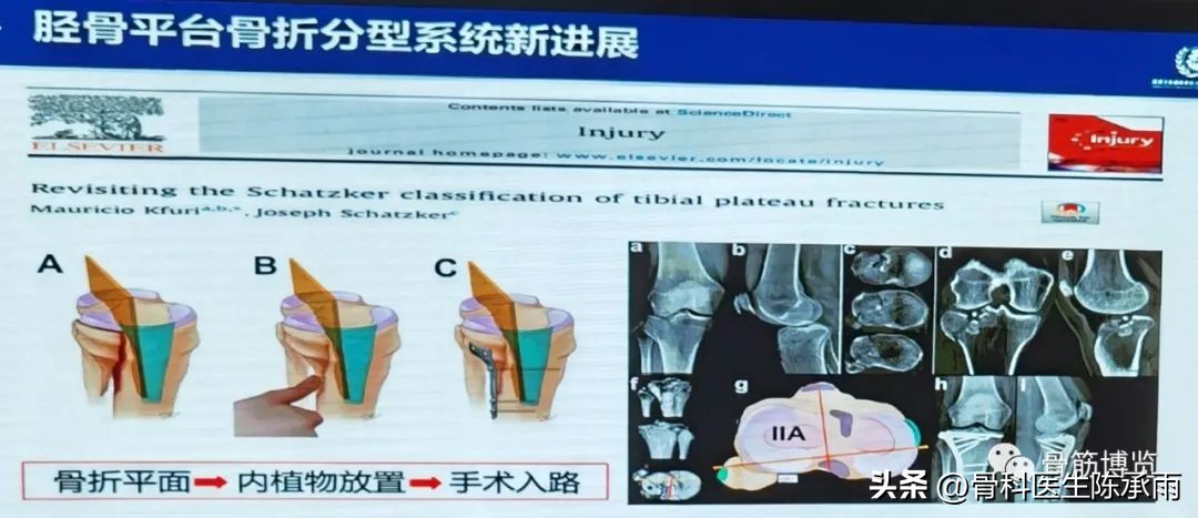 国家卫健委主办的骨创伤专项能力培训项目----下肢损伤学习班