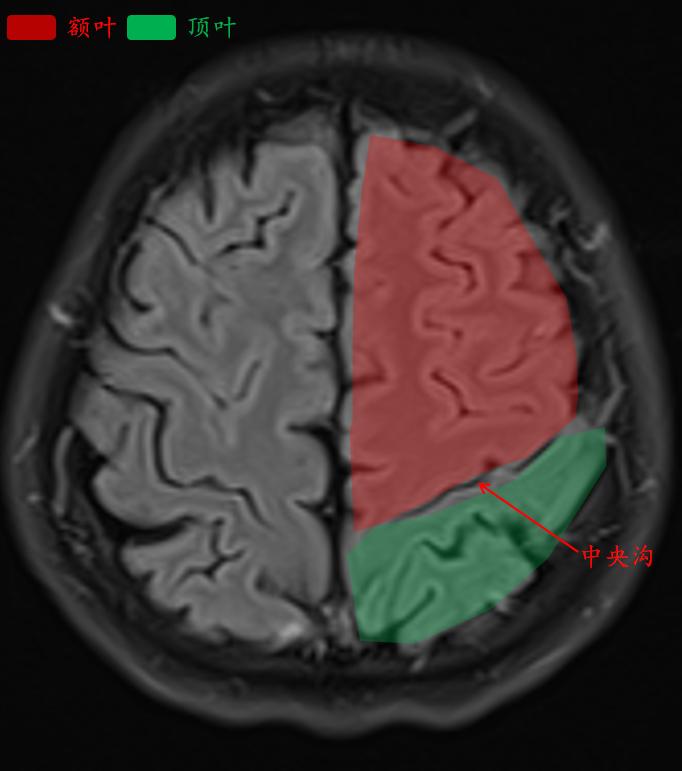 肘关节mri图谱大全,腕关节mri解剖图谱