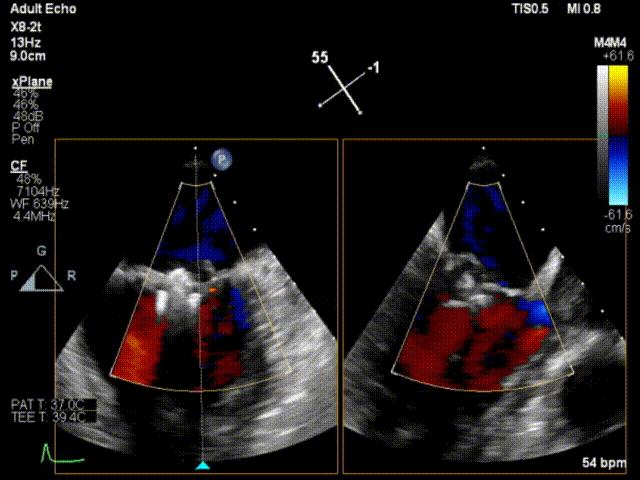 杨剑教授中国科学院,西京医院心血管外科杨剑