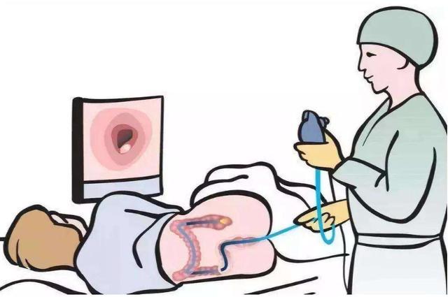 做肠镜尴尬怎么办,男医生给女病人做肠镜合适吗