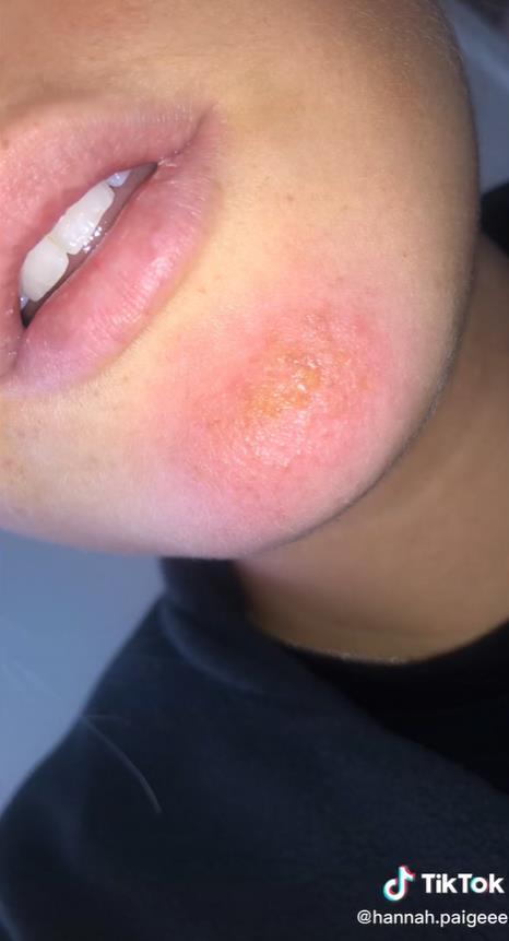 澳洲妹子和男友接吻,澳大利亚女子与男友接吻