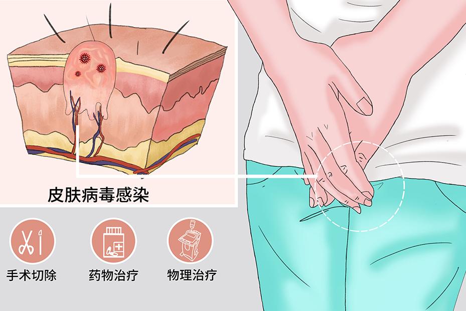 你洗屁屁吗？肛门也需要保护，医生：经常清洗肛门，预防这3种病