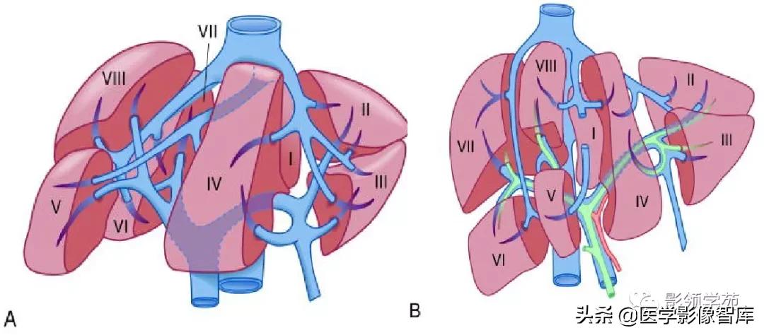 肝脏影像分叶分段解剖图,肝脏分段解剖图谱