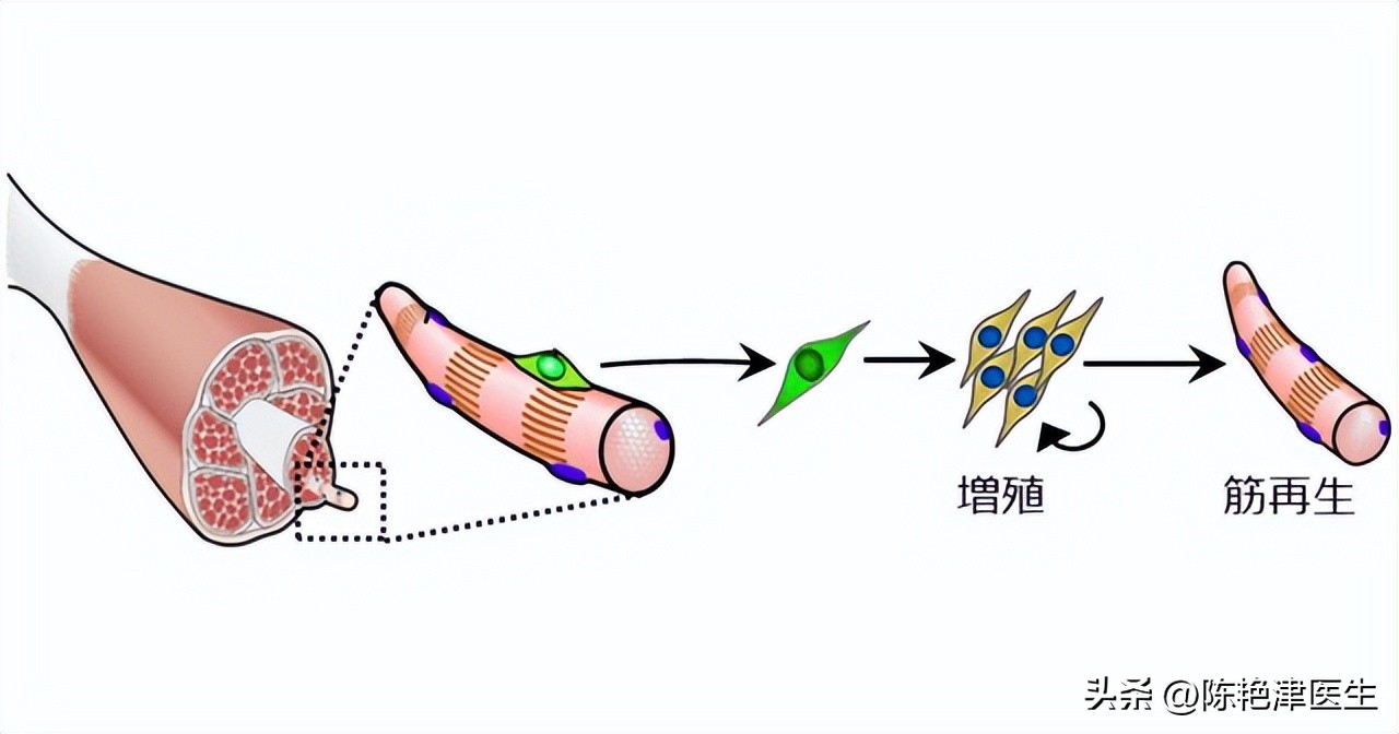 女性为什么容易长子宫肌瘤?提醒:平时尽量避免3个行为,别忽视