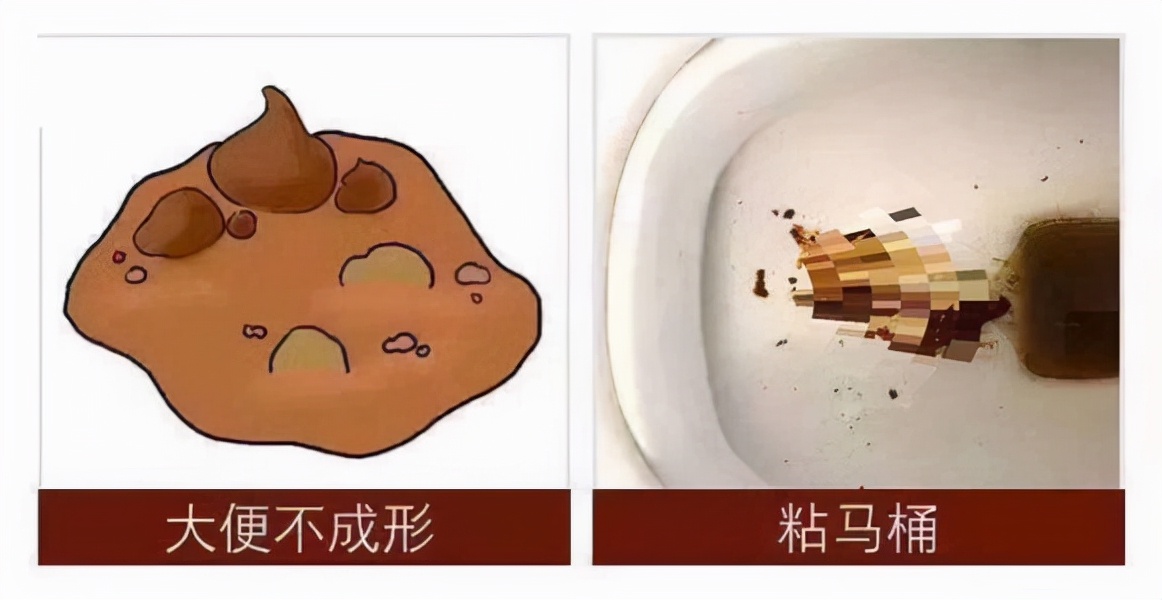 舌头上有裂纹是什么原因中医辨证,横裂纹舌代表阴虚竖裂纹代表阳虚