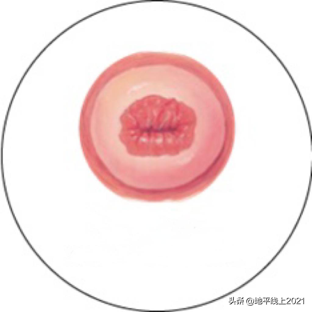 女性宫颈为啥老出问题,宫颈常见问题有哪些