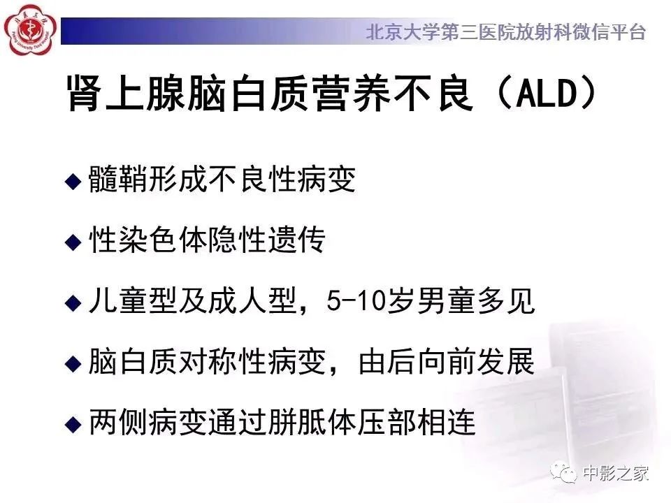 什么叫原发性胼胝体变性,原发性胼胝体变性治疗多少钱