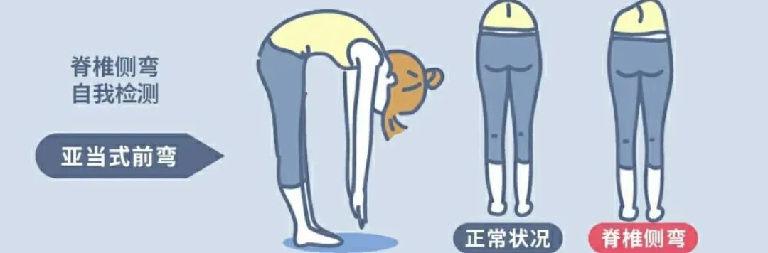 看起来胖实际没多重,胖有可能也是营养不良图文