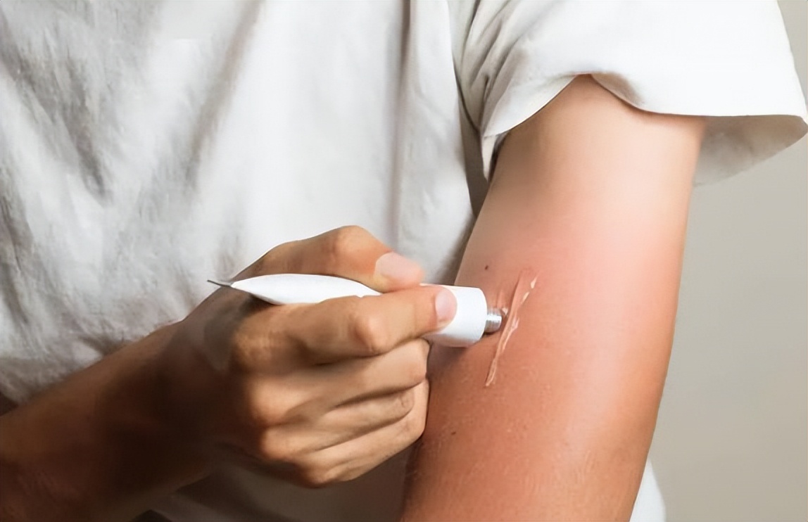 长期用红霉素软膏涂抹脸部皮肤,用红霉素软膏涂眼睛