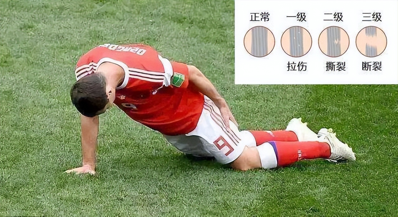 肌肉拉伤能不能继续训练,肌肉拉伤一周后可以训练吗