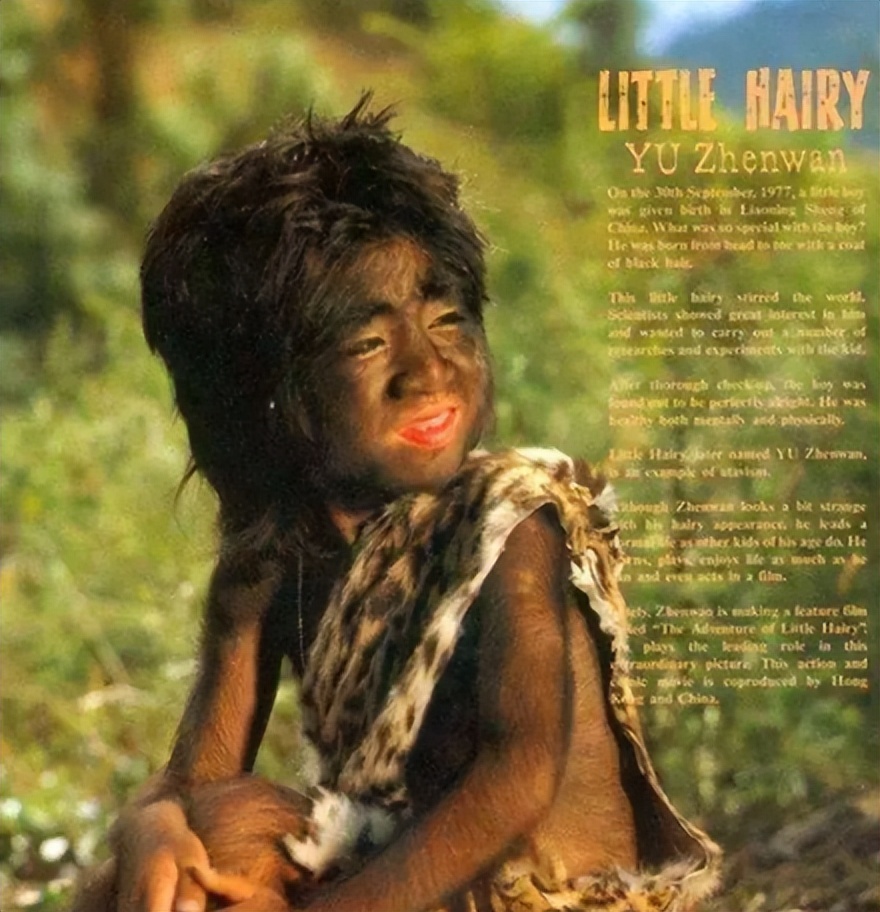 当年轰动一时的“毛孩”：42岁娶90后娇妻，生下一子未遗传长毛