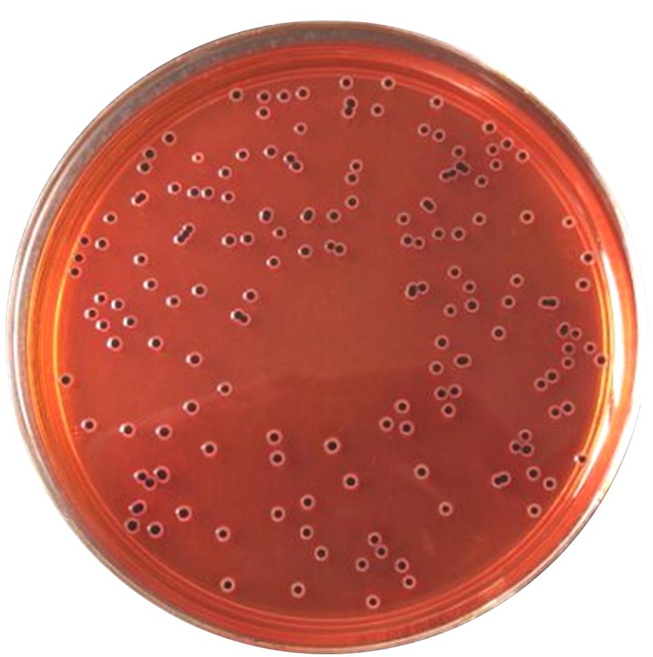 食品微生物沙门菌检验流程,食品中沙门氏菌的检测视频