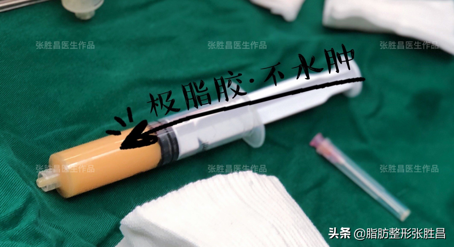 第一次做手术的人心里有点怕,第一次做脂肪填充效果