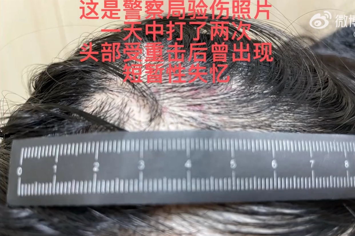 演员王东家暴妻子上热搜，同名主持人无辜躺枪，百度百科急忙修改