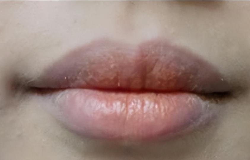 嘴唇发紫是心脏什么问题,心脾两虚的嘴唇是发紫吗