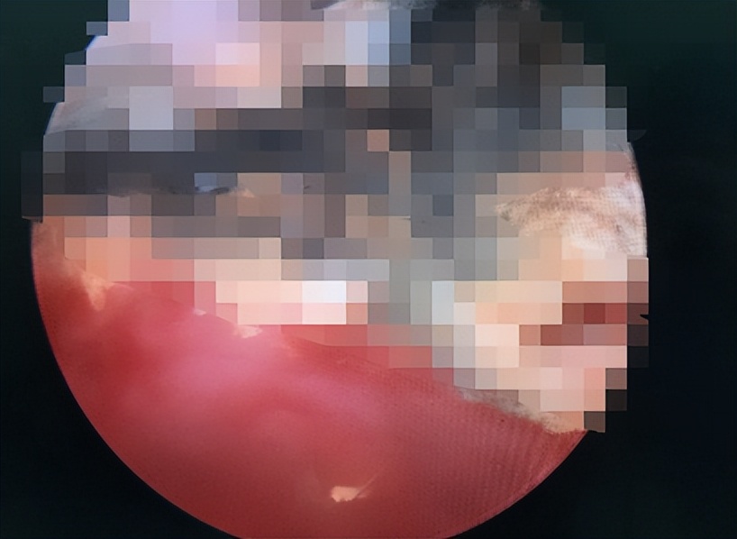 7岁女孩死亡体内却有异物,少女体内被埋神秘异物